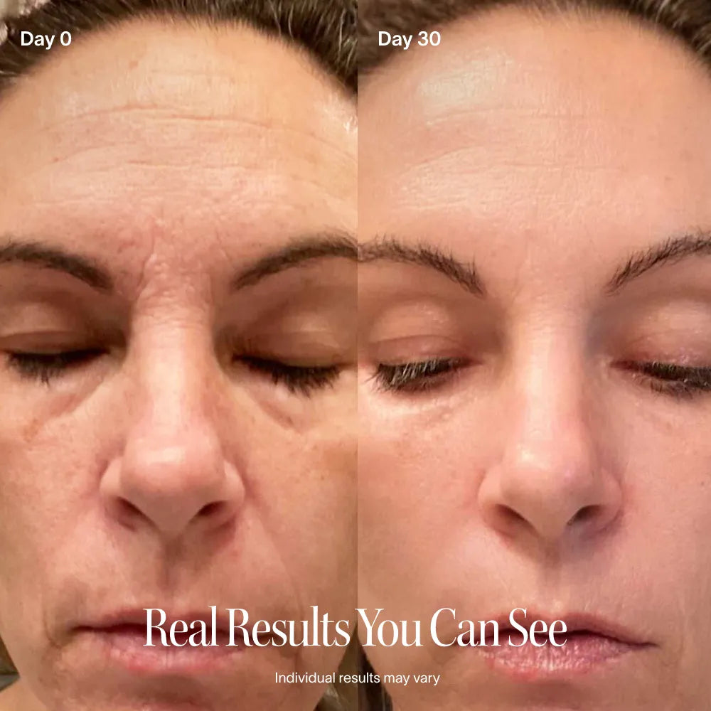 Neck & Face Lifting LED Therapy Device